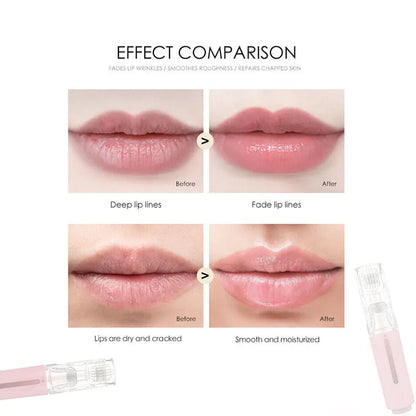 Lips Micro-Needle and Serum